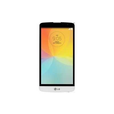 Reparar LG Bello | Cambiar Pantalla LG Bello | España